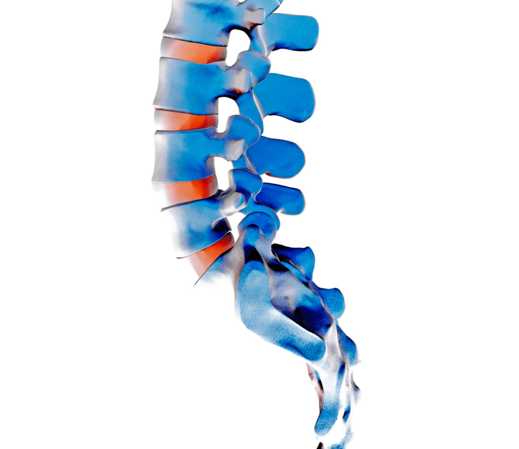 herniated disc pain doctor in south beach miami