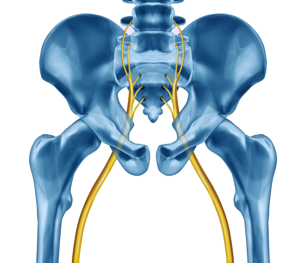 sciatica pain miami